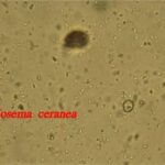 Mikrosporídie Nosema spp. – obligátne včelie parazity prenášané vzduchom